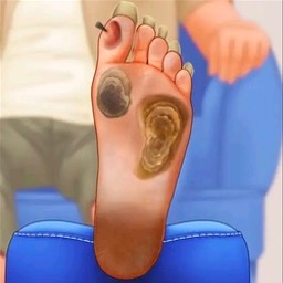 修脚足疔模拟器汉化版