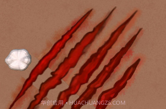 外科手术大师v0.20截图