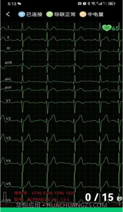 心电一张网截图2
