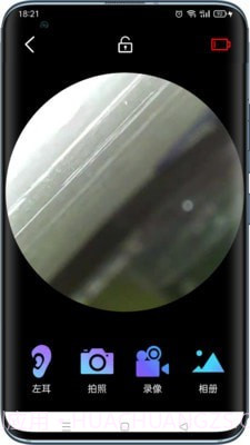 可视采耳仪截图3 可视采耳仪截图3