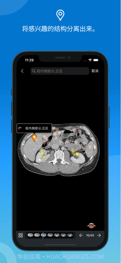 e-anatomy截图3 e-anatomy截图3