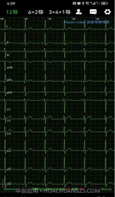 心电一张网截图4