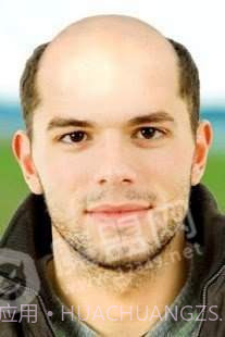 秃头生成器中文版截图3