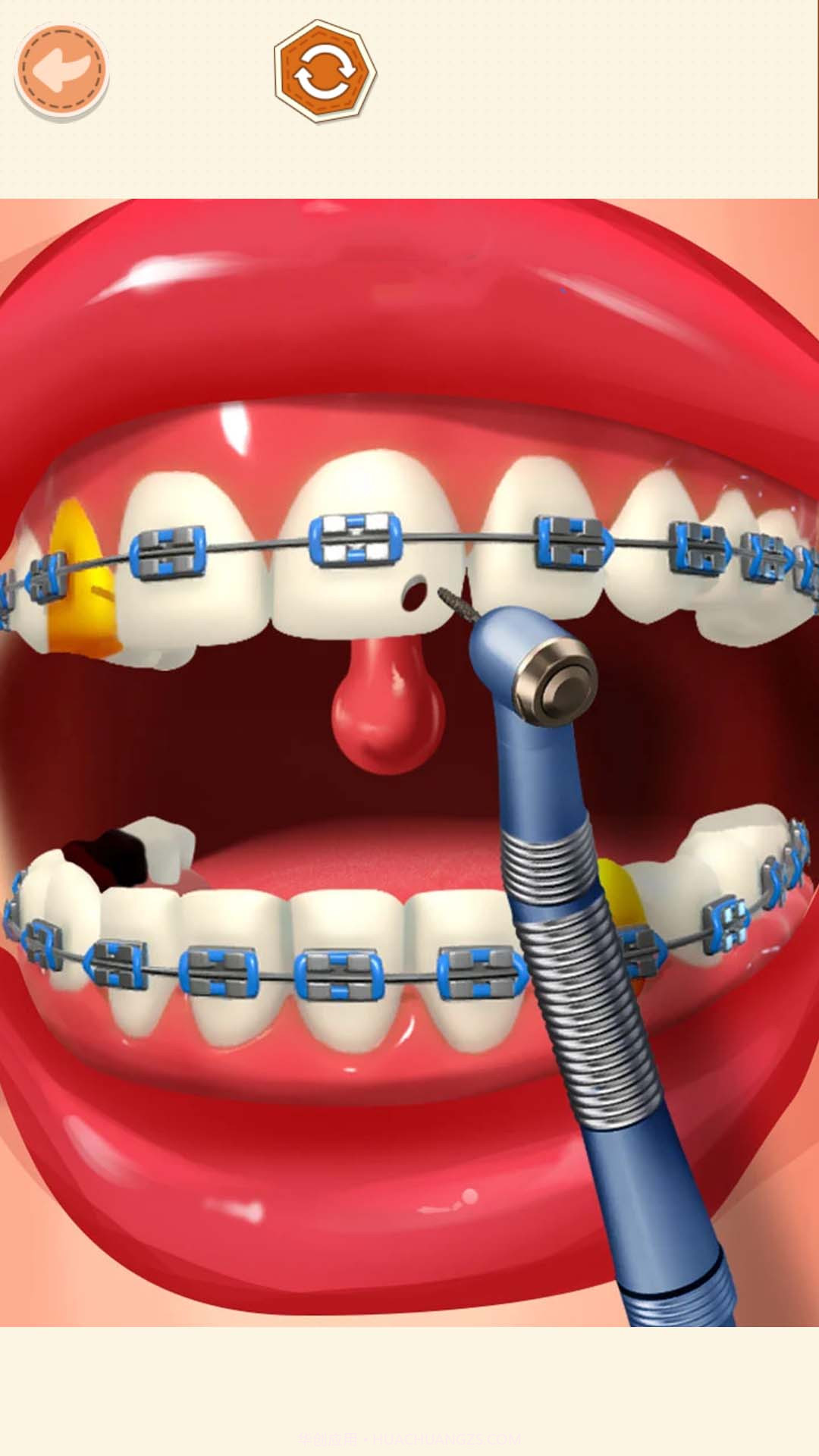 高级医生模拟截图4