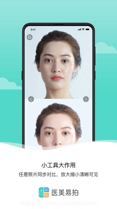 医美易拍截图2 医美易拍截图2