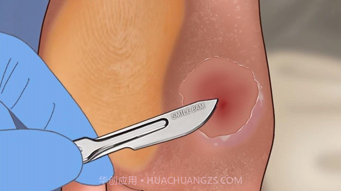 修脚足疔模拟器免广告版截图3 修脚足疔模拟器免广告版截图3